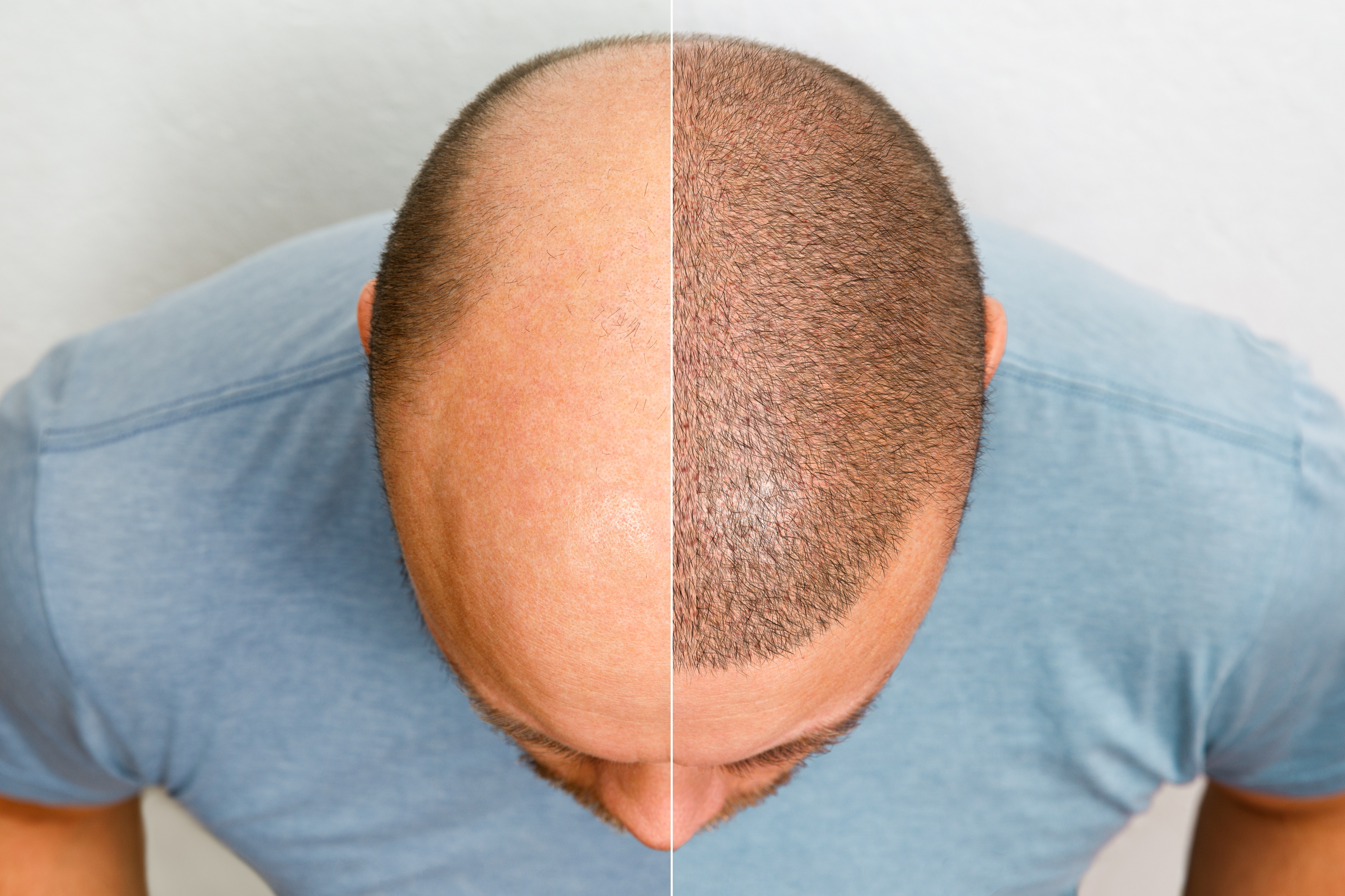Treatment Image